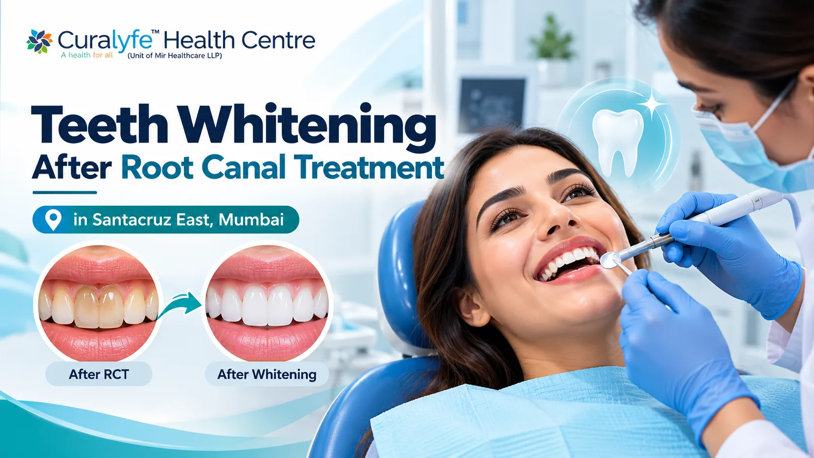 Curalyfe Teeth Whitening After Root Canal Santacruz