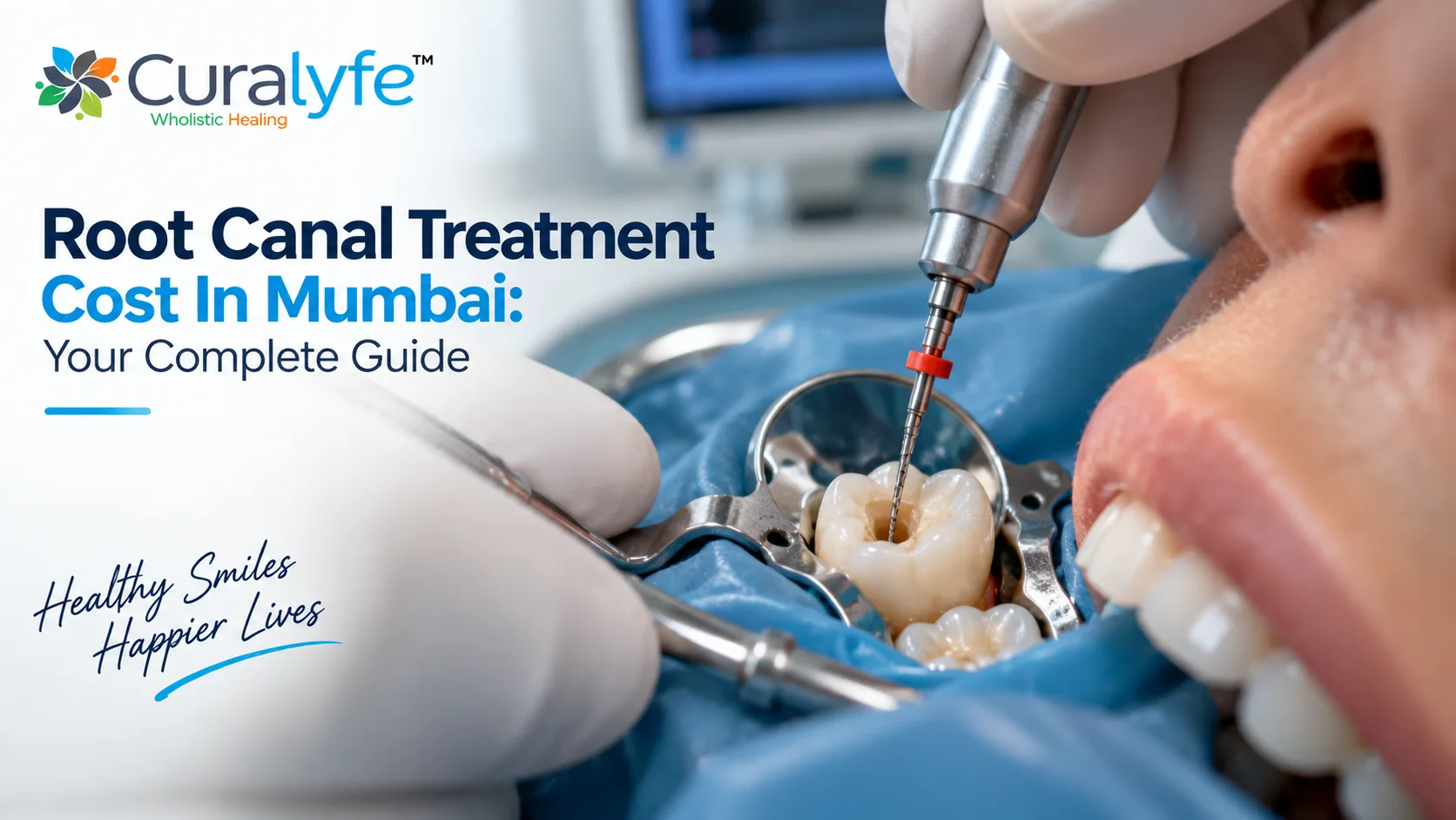 Root Canal Treatment Cost in Mumbai: Complete Guide