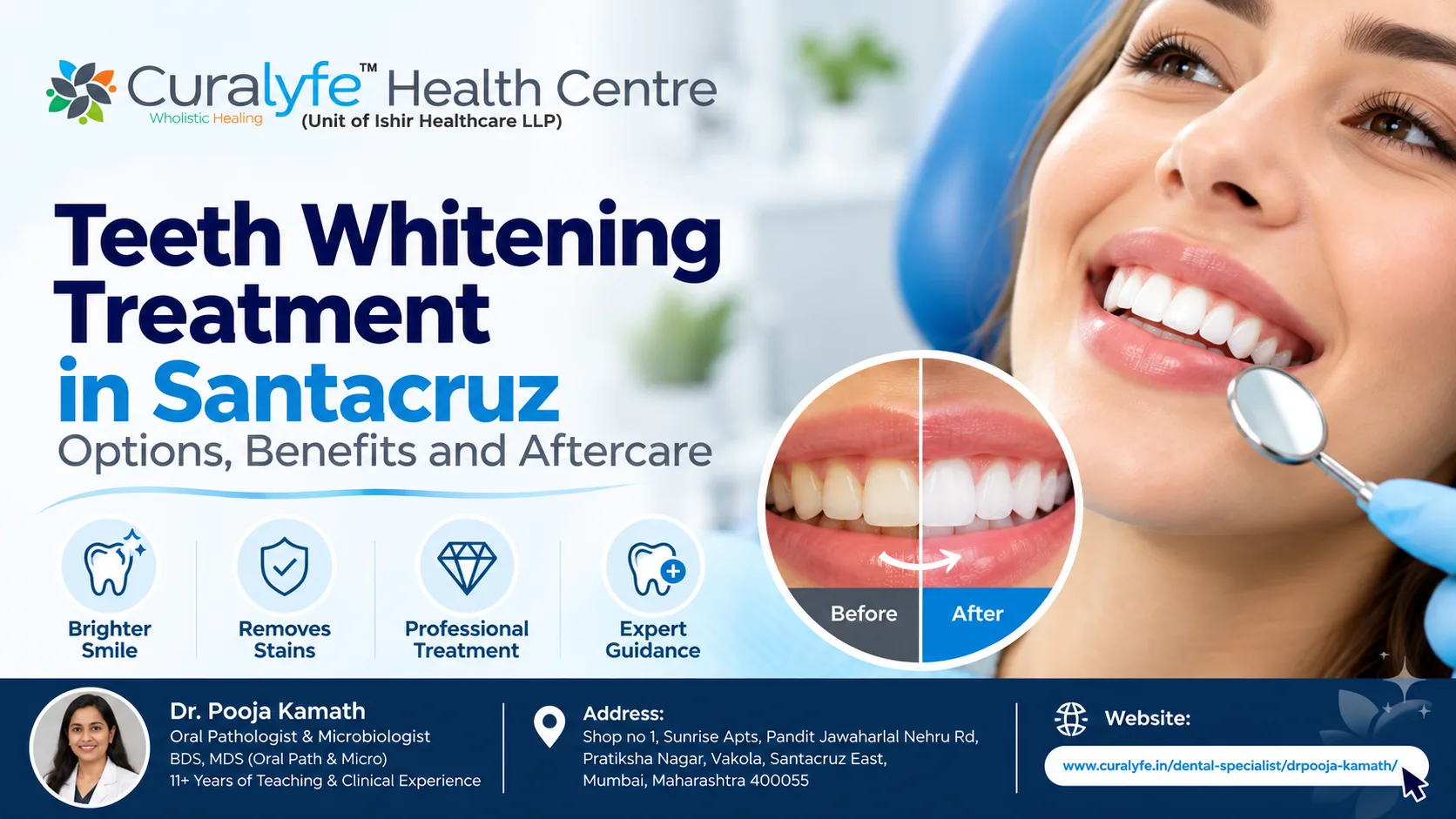 Teeth Whitening Treatment In Santacruz